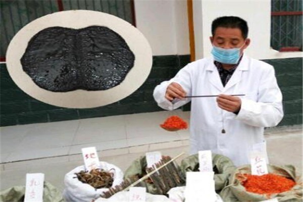 椎風(fēng)益土家土方黑膏加盟