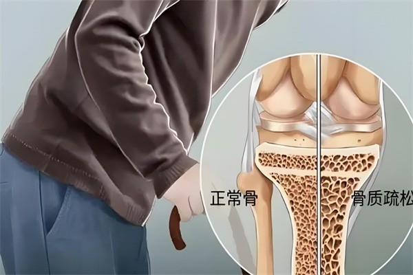 正逸堂古方養骨加盟